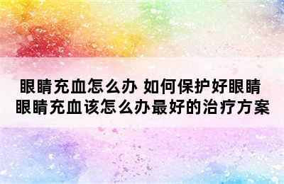 眼睛充血怎么办 如何保护好眼睛 眼睛充血该怎么办最好的治疗方案